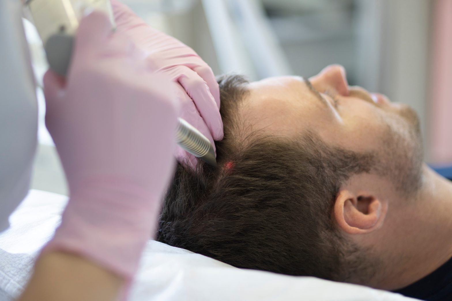 Hair Rejuvenation vs. Hair Transplants: Which Is Right for You?