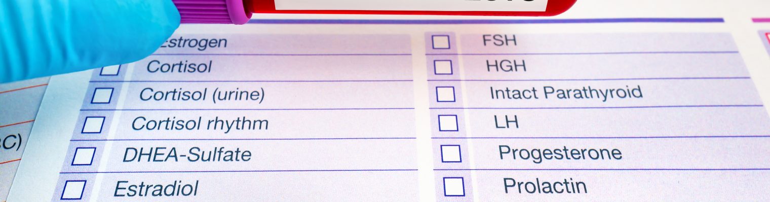 What Should You Expect During Hormone Level Testing and Evaluation?